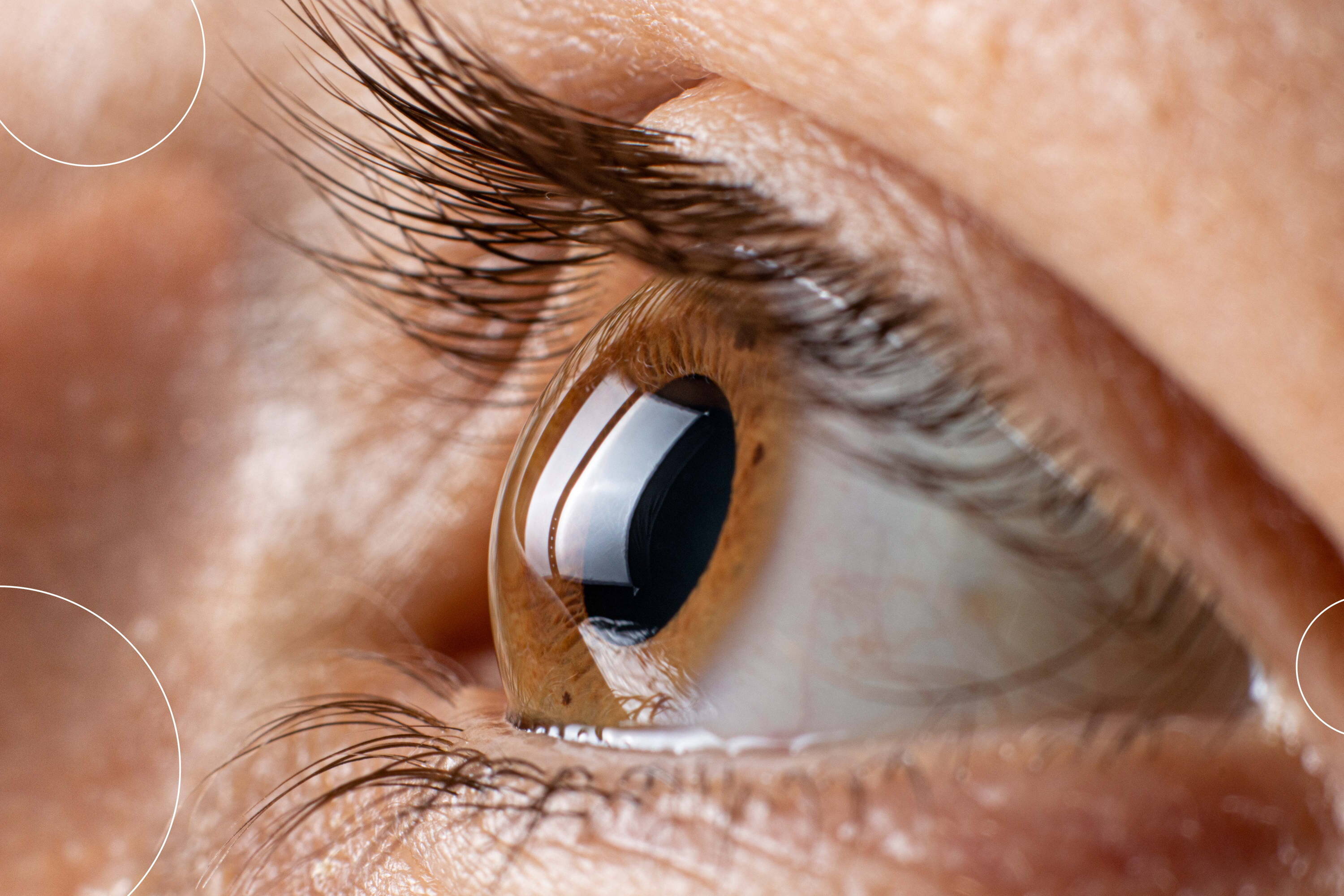 Foto del ojo de una persona. La idea es representar cómo se ve la córnea curvada de una persona que padece astigmatismo